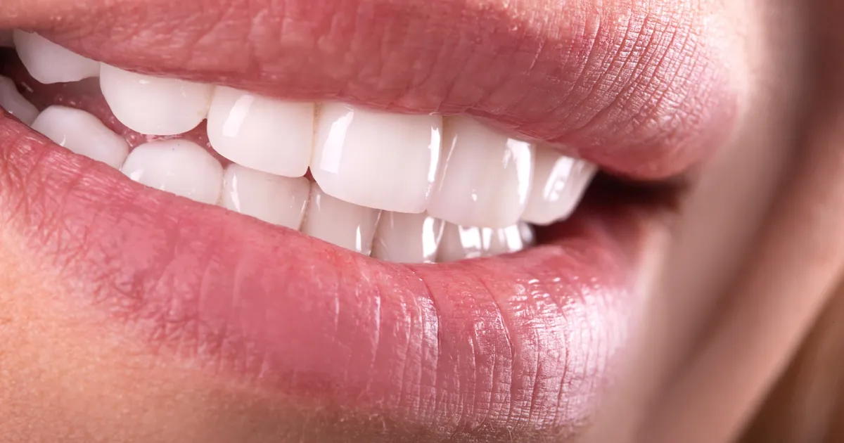 Kuidas tuhmid või trauma tagajärjel viga saanud hambad korda teha?