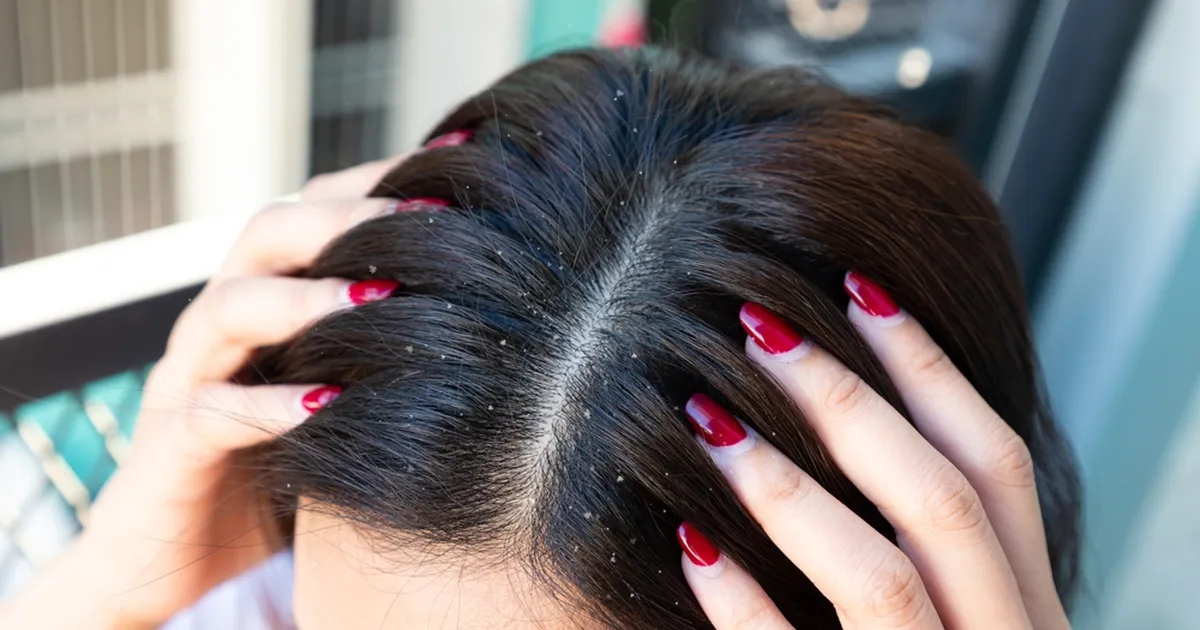 TASUB TEADA ⟩ Nende viie vitamiini puudus röövib su ilu