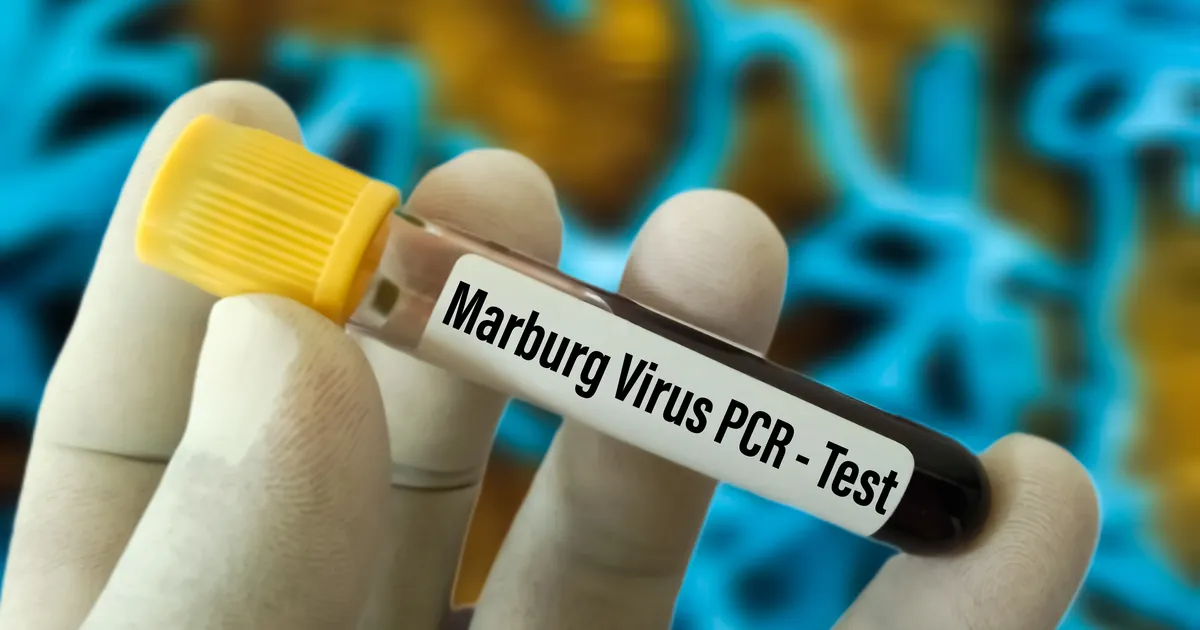 Ida-Aafrika riigis on surmava viiruse puhang