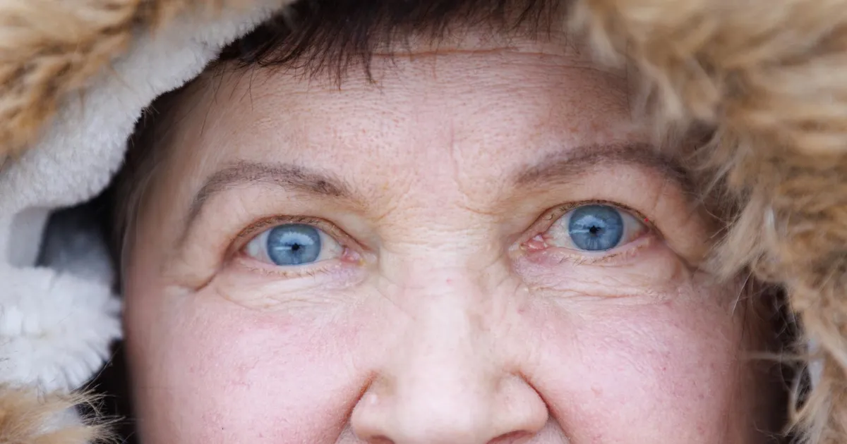 Saatuslike süstide järel nägemise kaotanud inimesi painab teadmatus