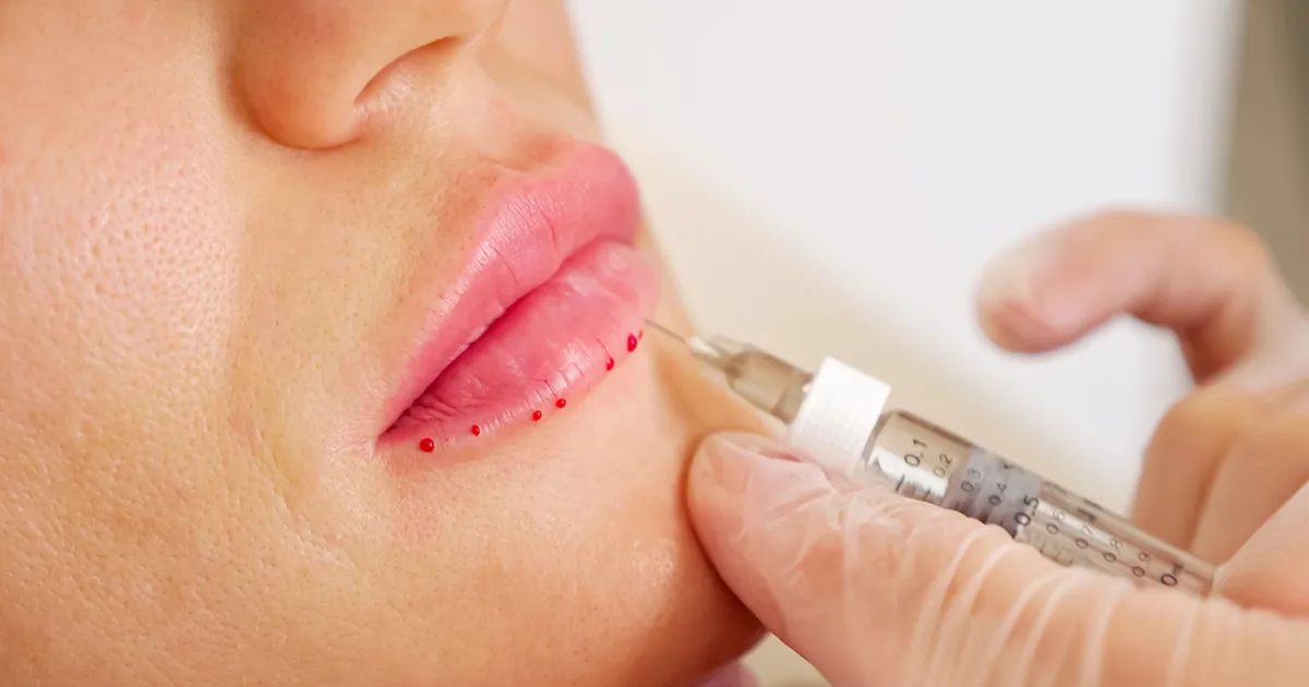 «Ainult viis protsenti juhtumitest lõppevad hästi. Enamik jääb siiski pimedaks.» Saates «Õhtu» arutati ilusüstide tõsidust