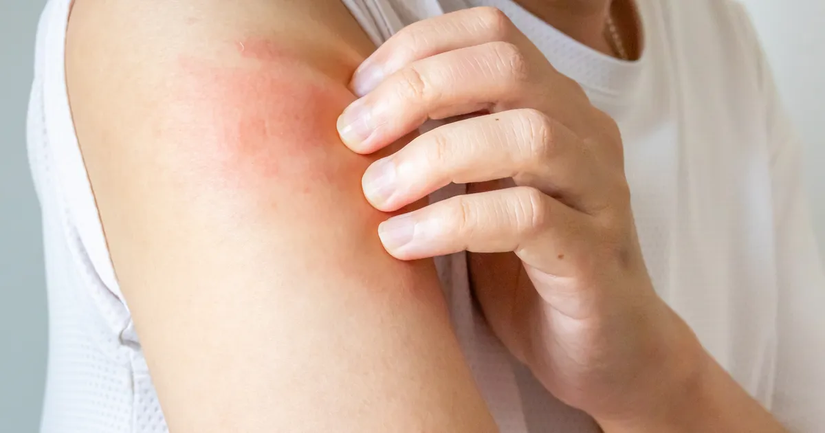 Apteeker annab nõu: milliseid nahahooldustooteid peaks talvel kasutama?