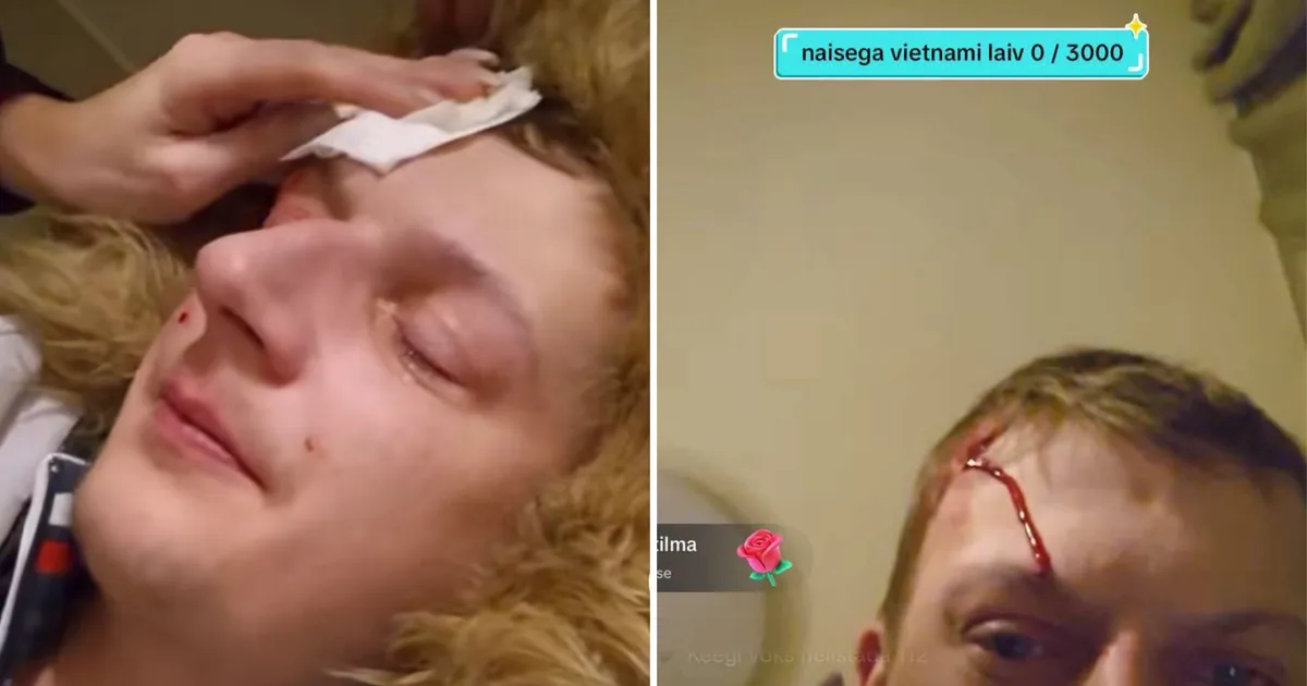 HÄIRIVAD KAADRID ⟩ «Mul on pea läbi pekstud!» Tiktokker AlksiTaksi endine kallim lõi mehel otseülekandes pea veriseks