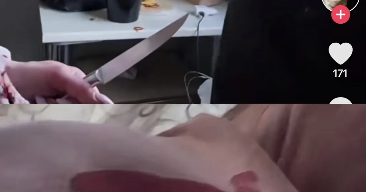 NÕRGANÄRVILISTEL MITTE VAADATA ⟩ Hiljuti elukaaslaselt kolki saanud tiktokker AlksiTaksi sai Eesti Vabariigi aastapäeval TikTokis fännide ees nuga: tunnen kuidas mul verd voolab!