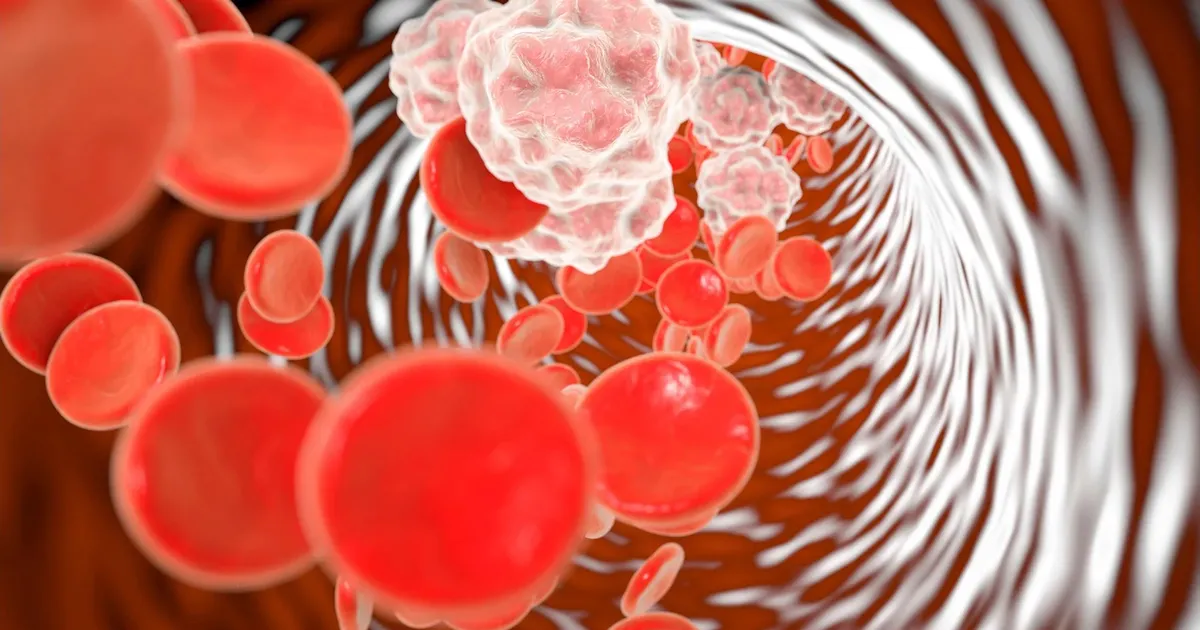 Uus põletiku tuvastamise meetod võib oluliselt muuta meditsiini