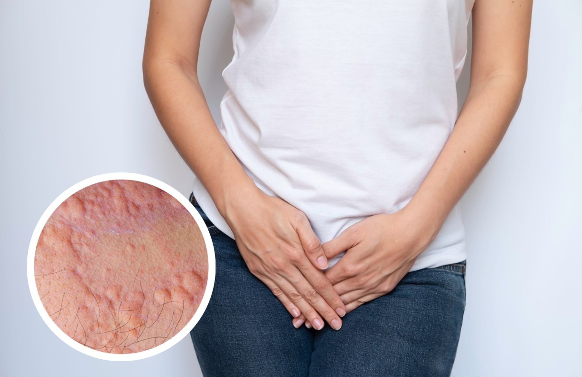 Intiimpiirkond sügeleb? Apteeker selgitab, mis on enamlevinud põhjused ja millega ärritunud nahka tohterdada