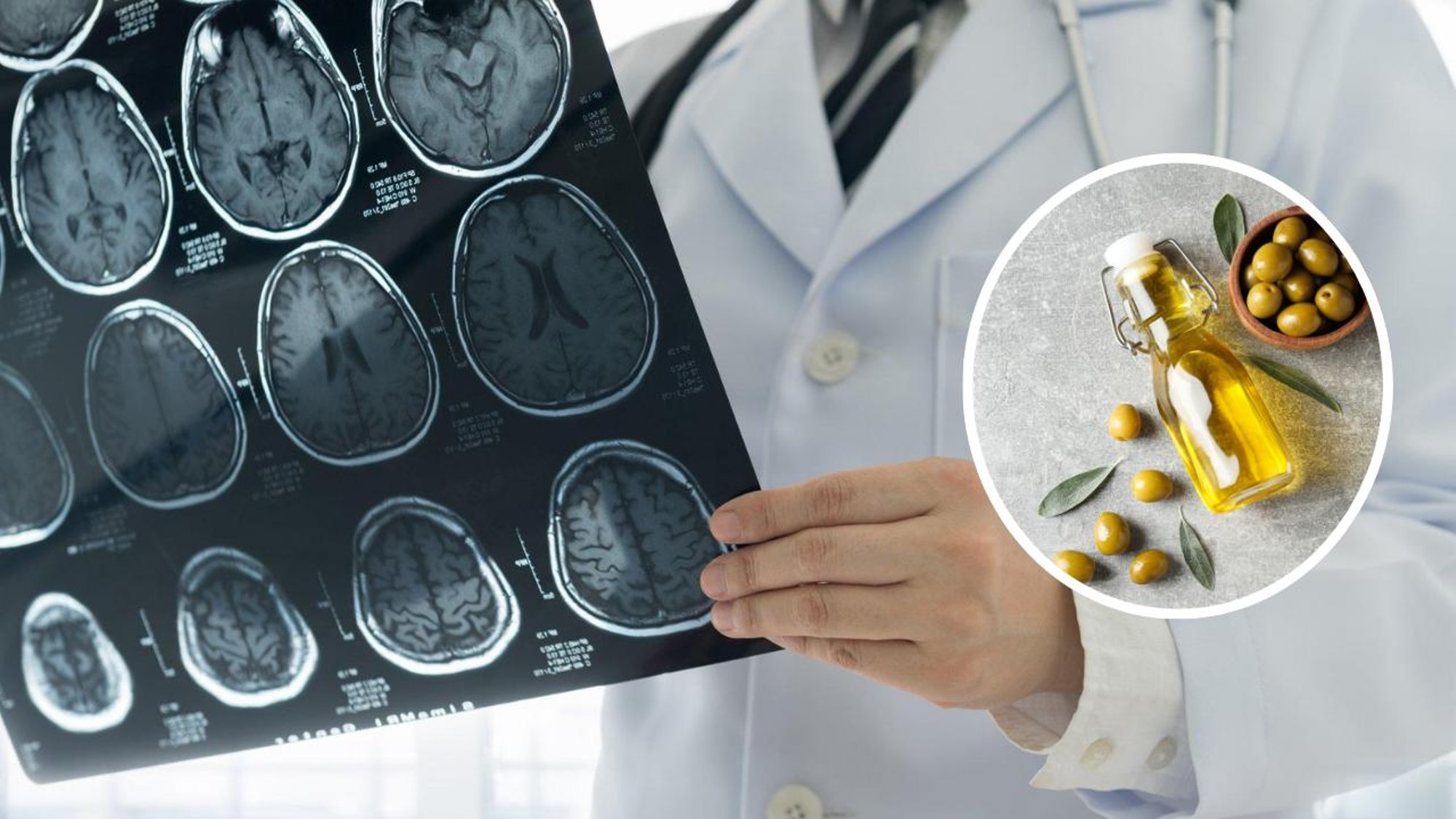 Oliiviõli tarbimine ja teised igapäevased harjumused, mille abil neuroloogid ise dementsuse riski vähendavad