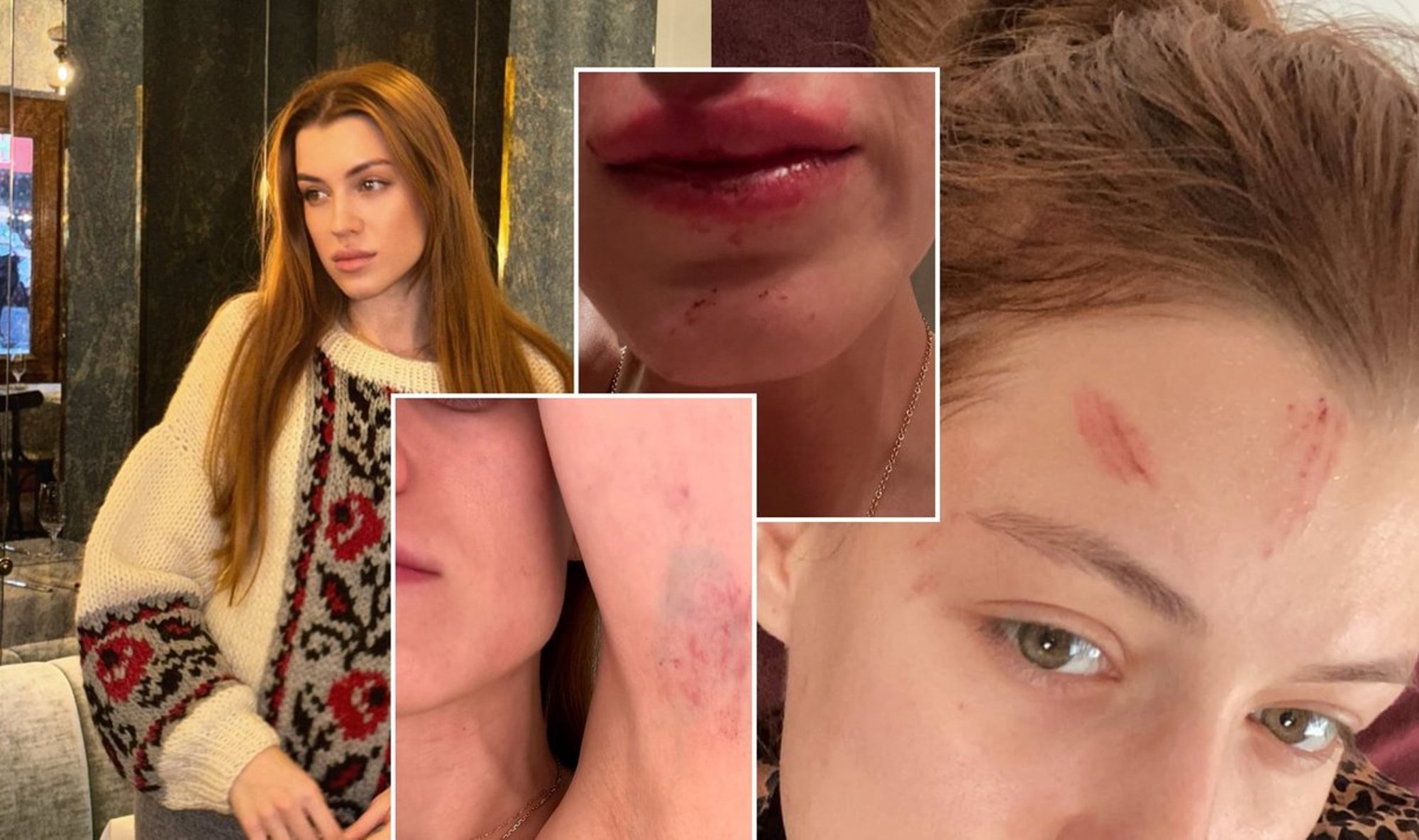 ŠOKEERIVAD FOTOD | Miss Ukraina langes koduvägivalla ohvriks: kui inimesed ütlevad, et nad muutuvad, siis ärge uskuge