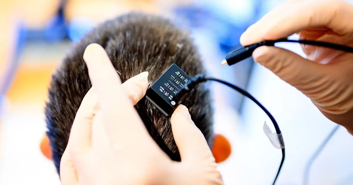 Mõtete lugemisest sünnib hääl: ajuimplantaat tõi tagasi kaotatud kõnevõime