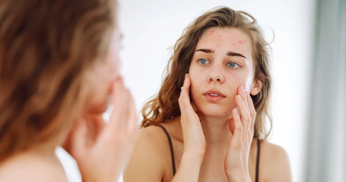 Nende kavalate nippide abil tuvastad, mis on sinu punnide põhjus