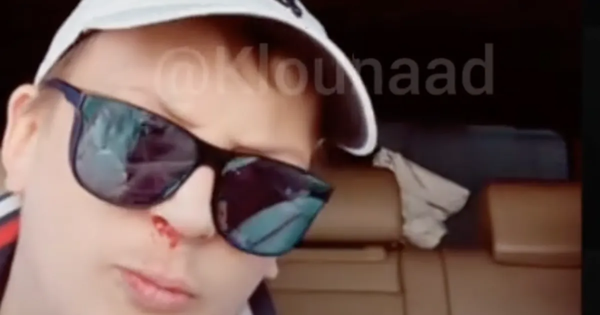 VIDEO ⟩ Tiktokker AlksiTaksi sai järjekordselt otse-eetris peksa: kuidas sa minuga räägid?