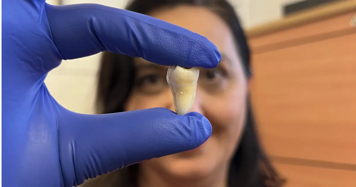 Teadlased leiutasid mooduse laboris hammaste kasvatamiseks