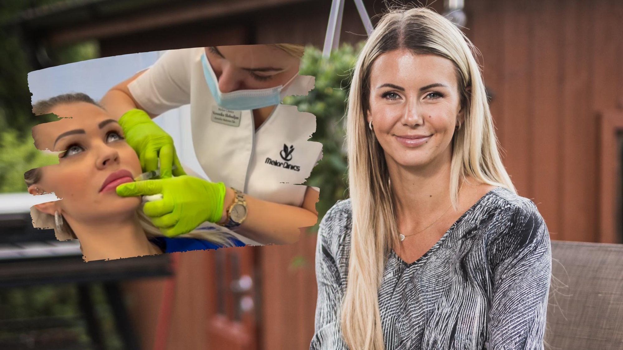 ÜLEVAADE | Naturaalsus on moes! Eesti tuntud naised, kes on naasnud oma loomuliku välimuse juurde