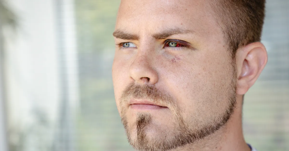 Kaks aastat tagasi Tallinnas rünnatud geipastor: pean tunnistama, et olen pettunud