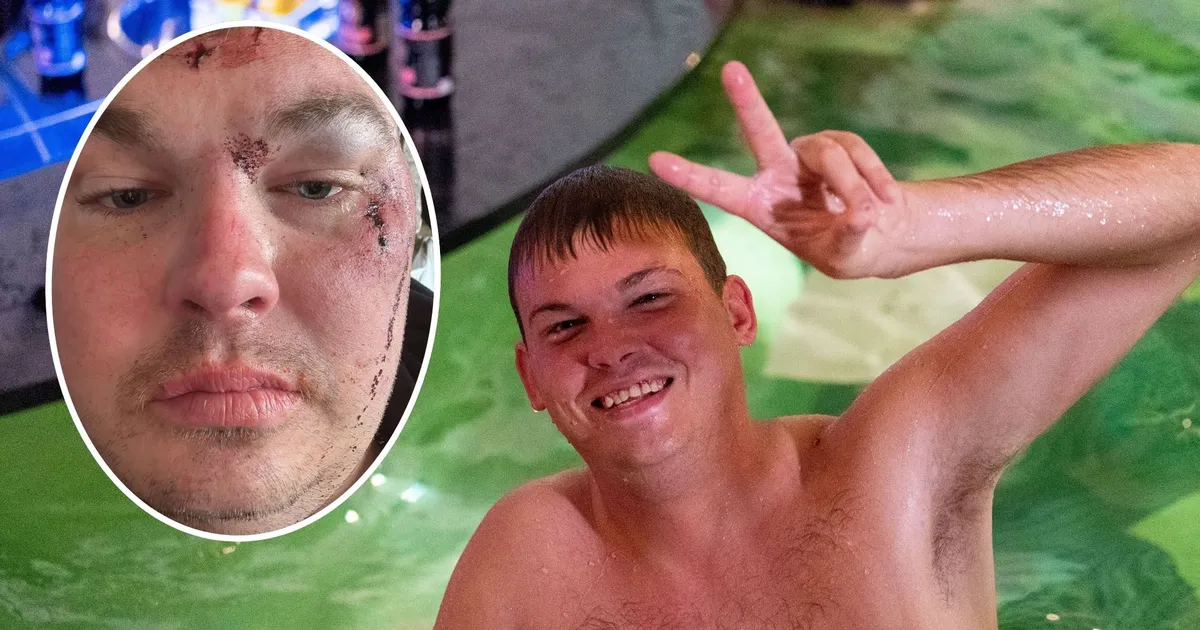 AUTO PURUKS ⟩ «Poissmeeste peo» Kevin tegi laupäeval joobeseisundis autoga avarii