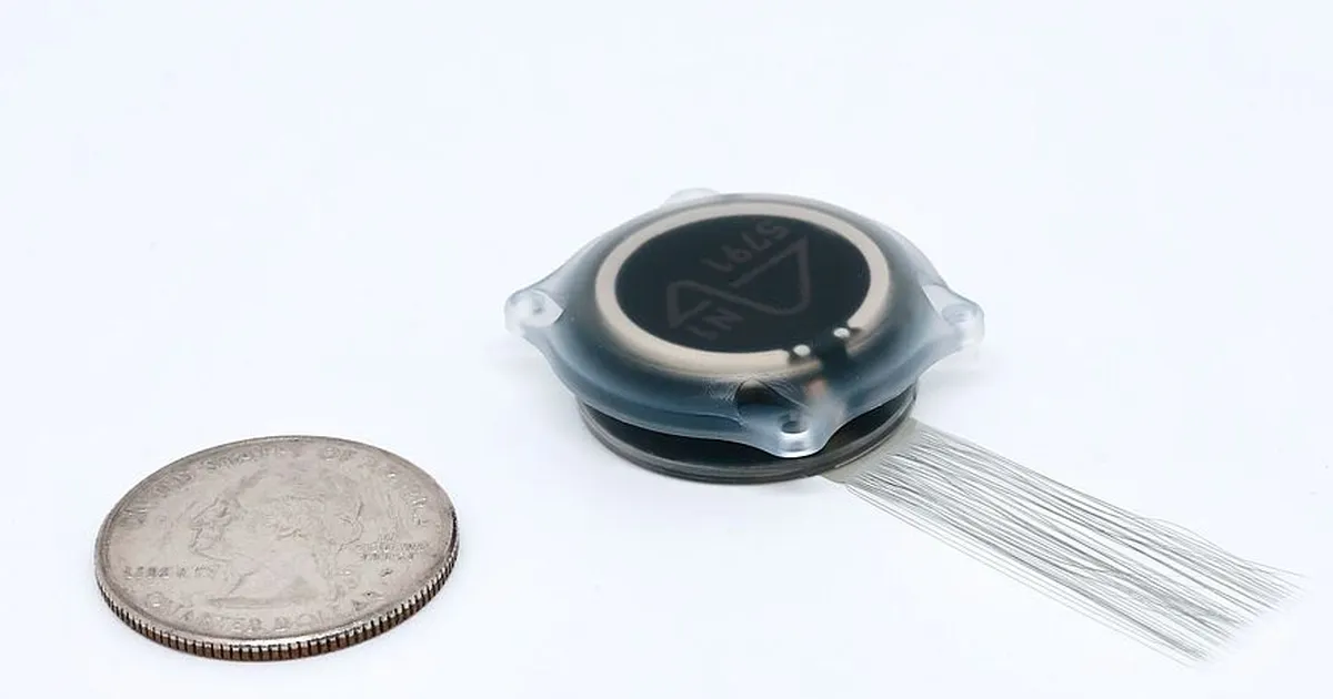 Inimese ja masina salaliit: Neuralinki patsient teeb oma arvutiga ühendatud ajuga imesid