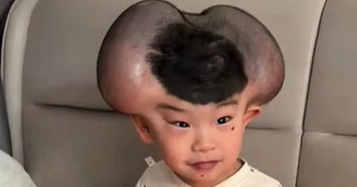 Imeline muutumine: moondunud laps sai lahti «Miki Hiire kõrvadest»