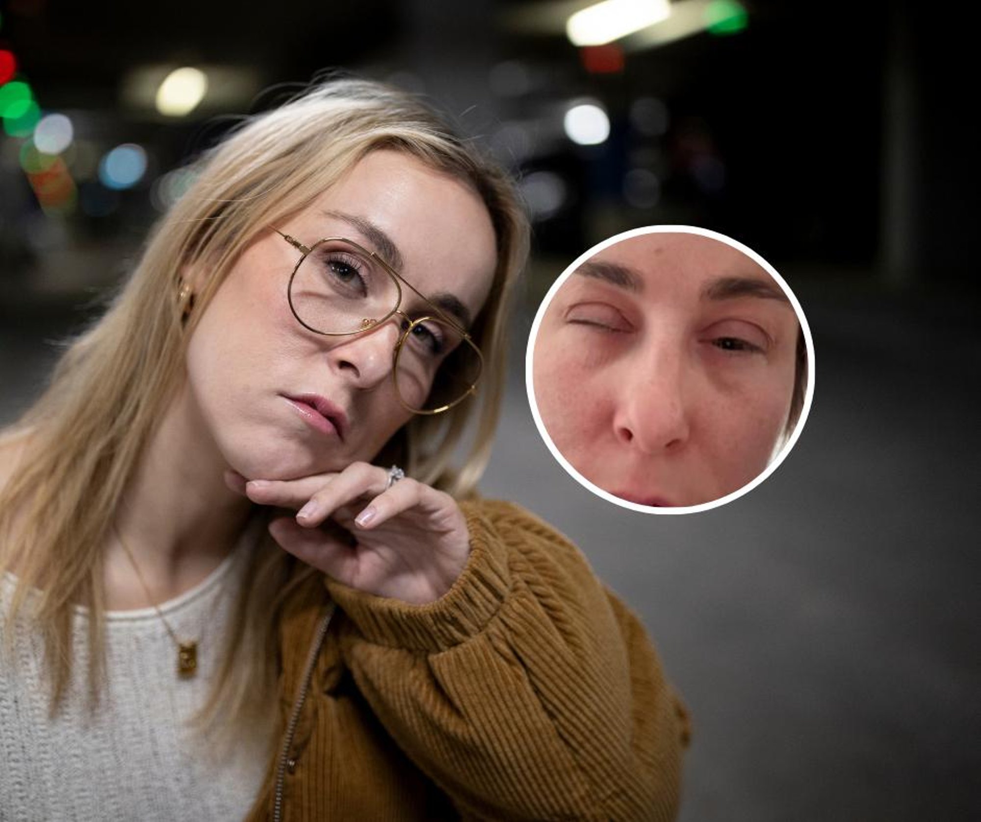 KLÕPS | „Tugevam tilk ja tablakas peale!“ Kristel Aaslaid ärkas üles tohutult paistes näoga