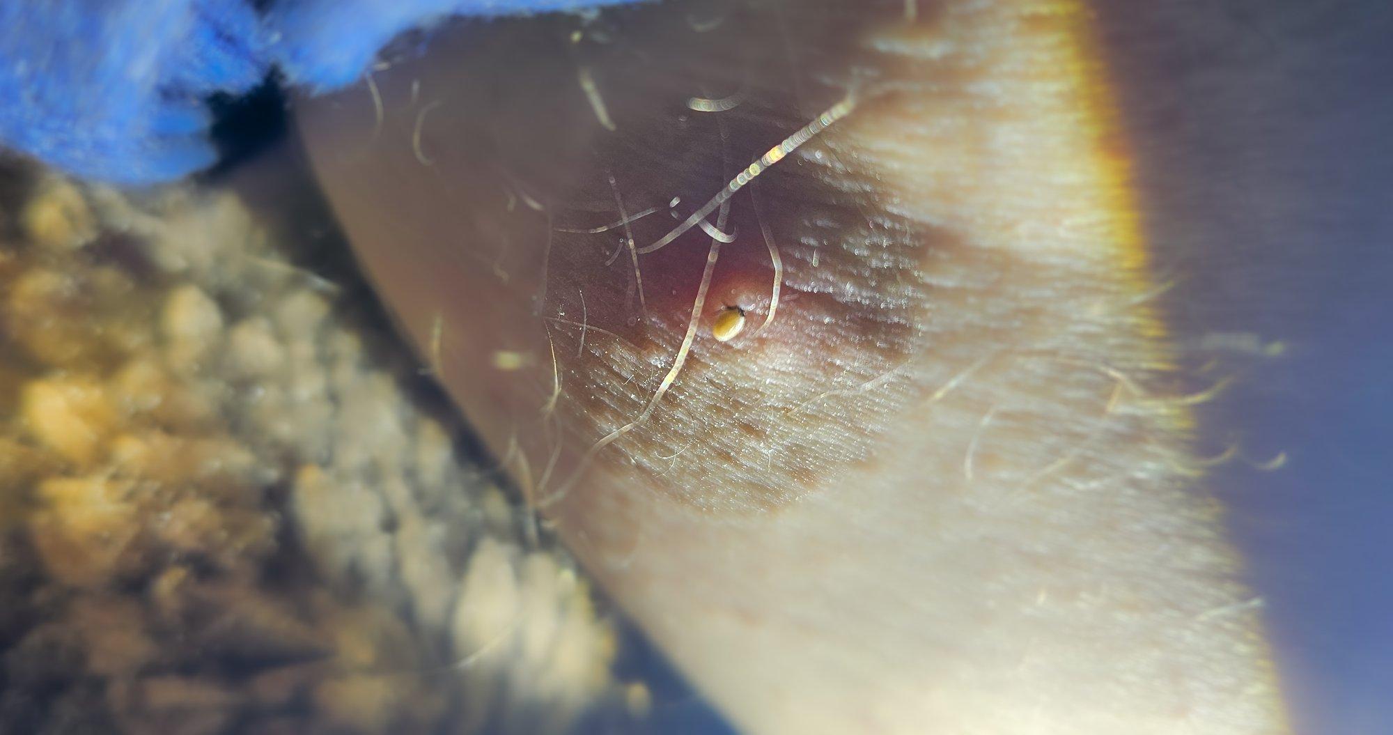 LUGEJA KÜSIB | Mulle imes end külge valget värvi puuk. Kas tegu on uue liigiga?