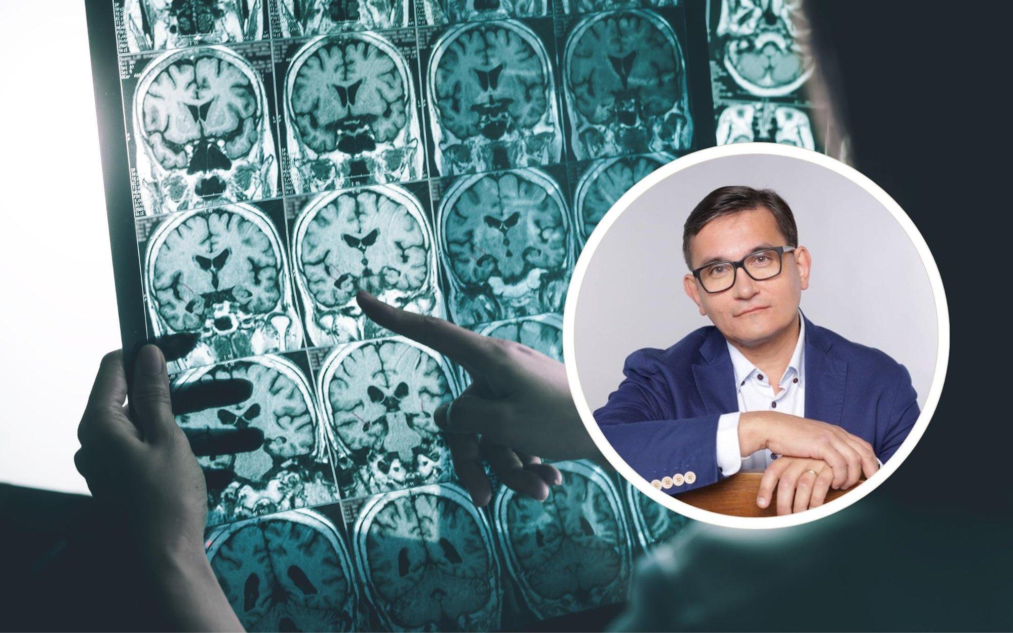 Pidev magusaisu? Veresuhkru liigne kõikumine võib soodustada ajuhaigusi. Neuroloog selgitab, kuidas ajutervist toetada