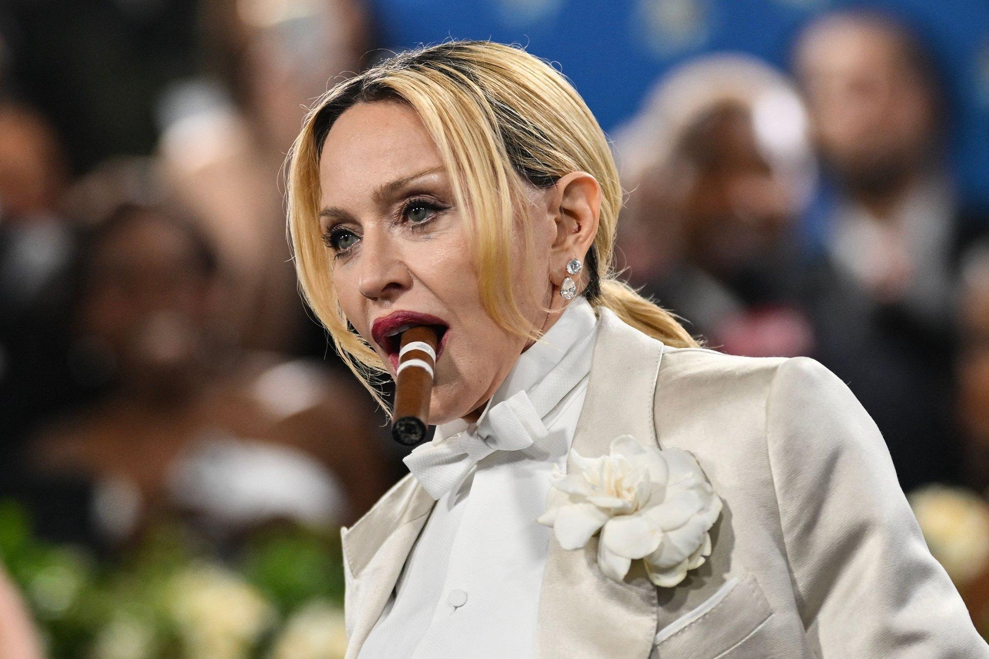 VÕRDLE | Täitesüstid on minevik? Madonna lasi naturaalsel ilul särada