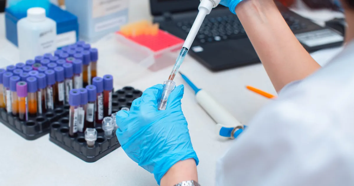 Teadlased avastasid täiesti uue veregrupi