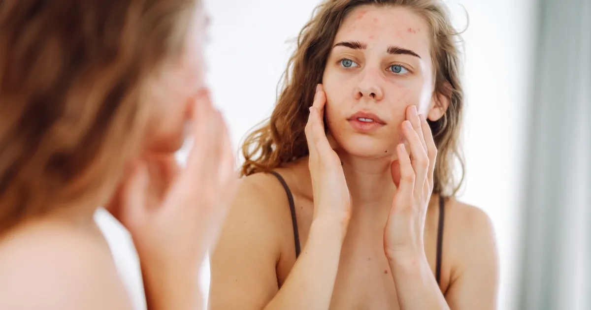 Need seitse toiduainet võivad olla valusate vistrike põhjuseks