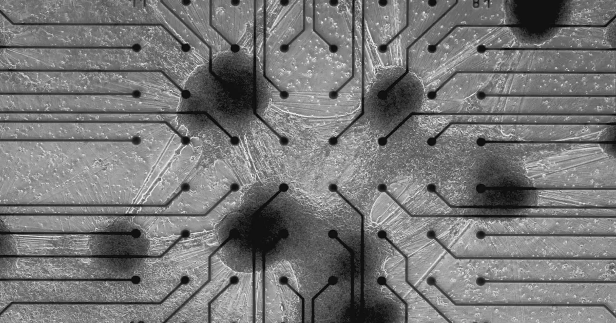 Vaata, millise trikiga turgutatakse inimese ajurakkudest tehtud arvutit