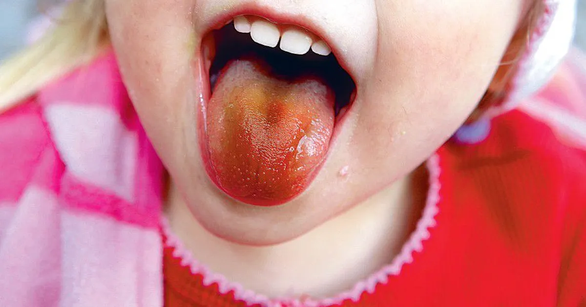 Sünteetilised toiduvärvid: silmailu, millel võib olla tervisehind