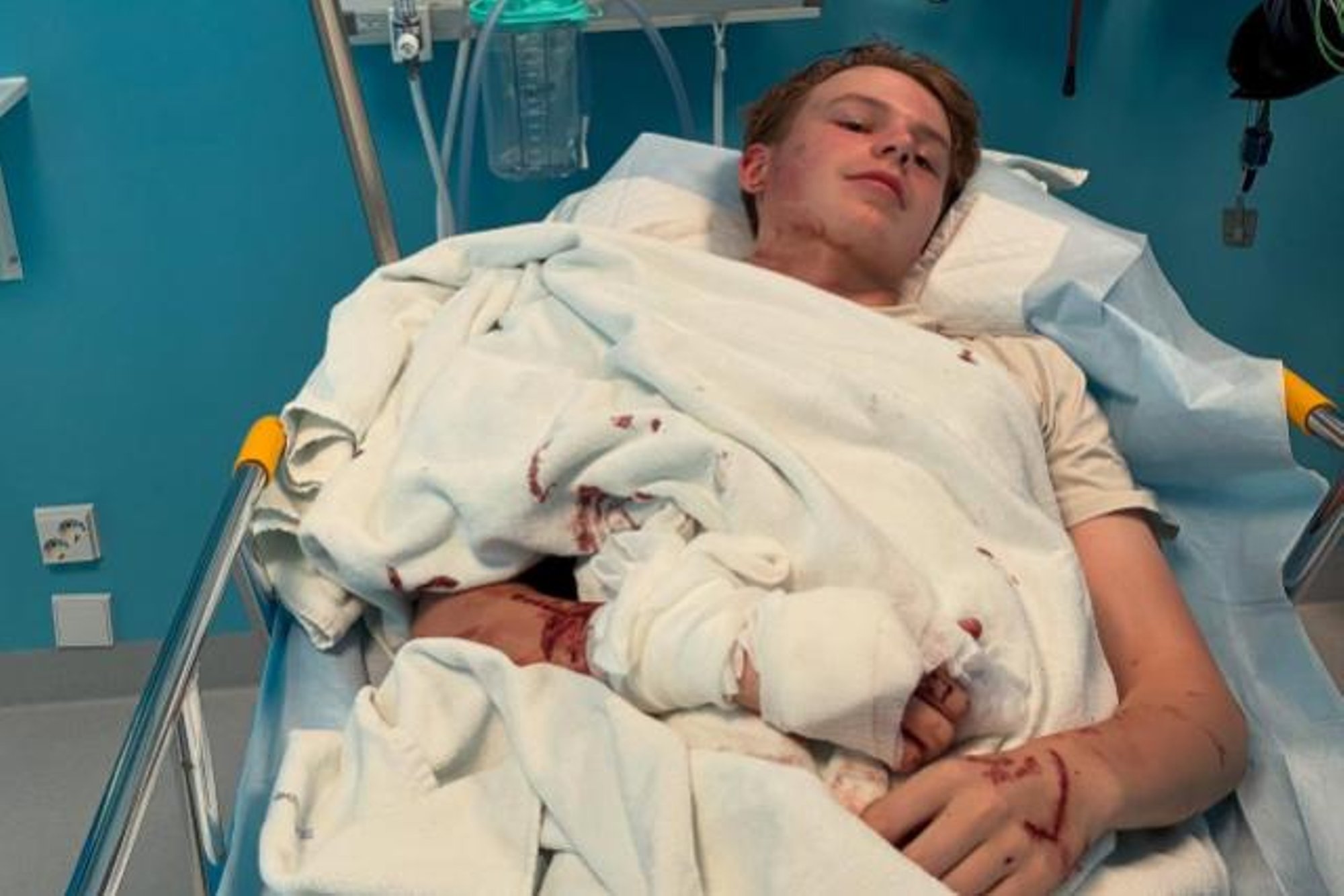 Šokeeriv õnnetus Soome padeliturniiril: klaasi lõhkunud 18-aastane mängija toimetati haiglasse operatsioonile