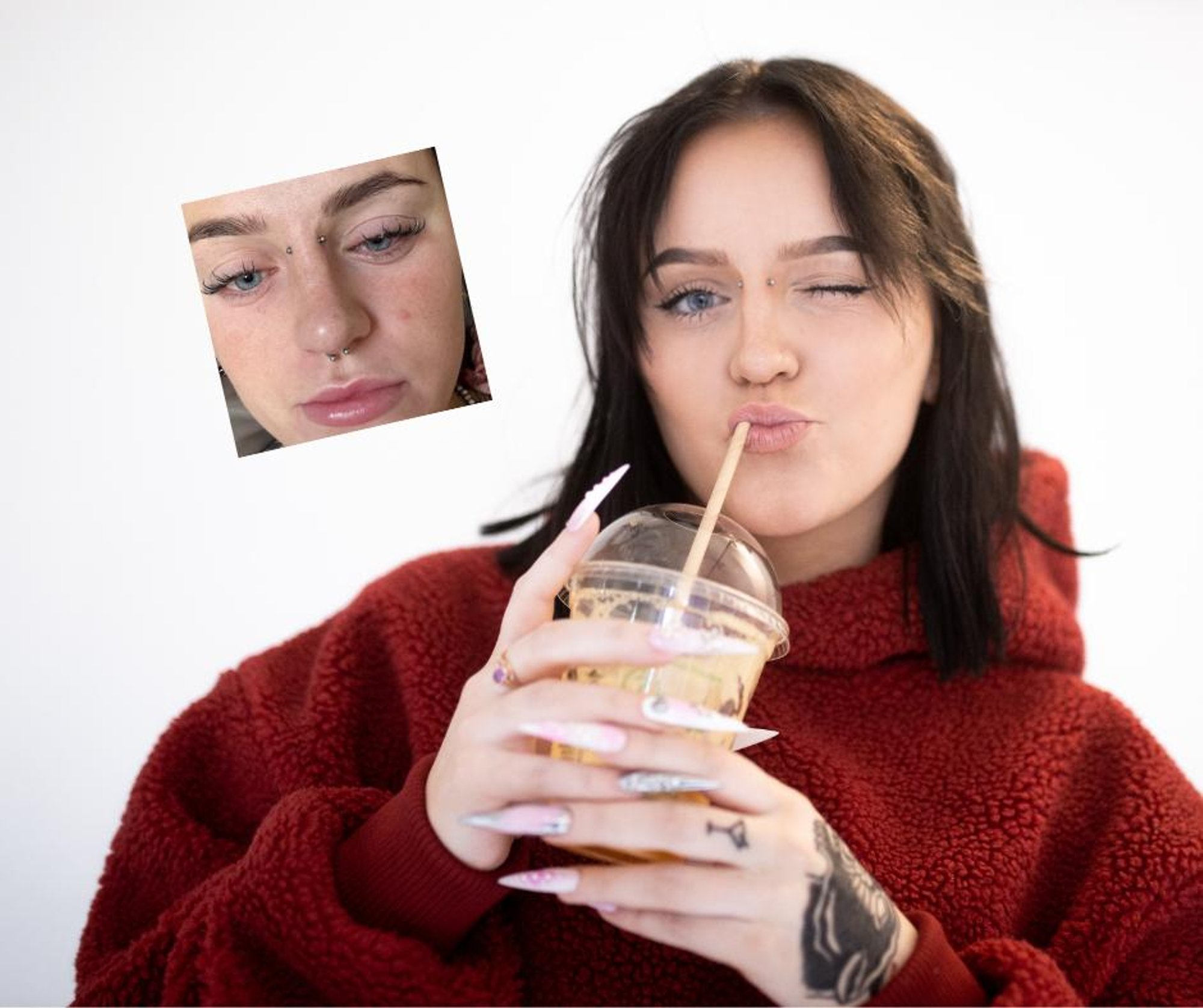 „Päris jube oli olla. Ma ei saanud hommikul silmi lahti teha!“ Läbitud iluprotseduur tekitas Mariliis Kaerale kannatusi