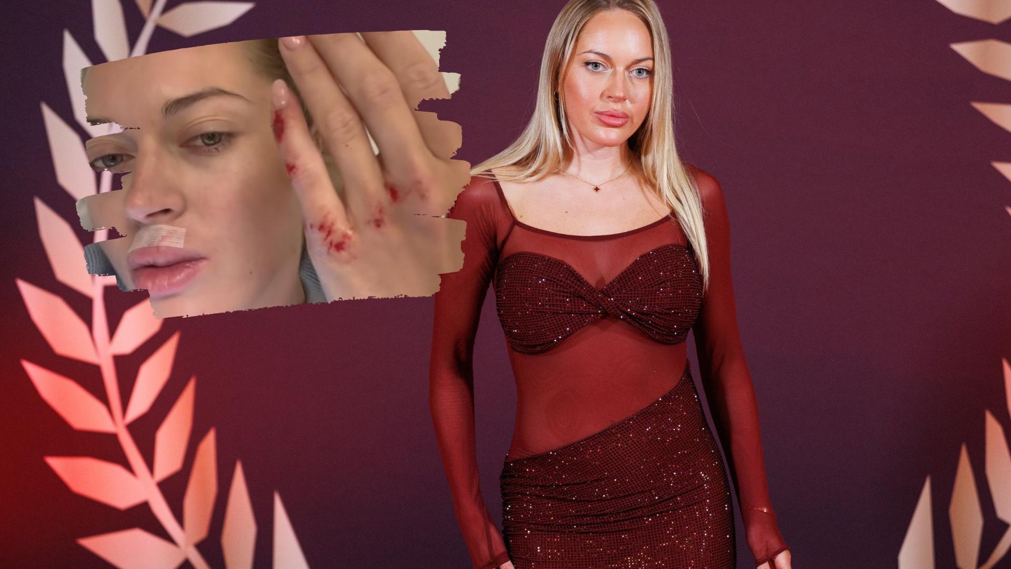 FOTOD | Õnnetus ei hüüa tulles! Erna Husko kukkus jalgrattalt nii õnnetult, et vajas kiirabi