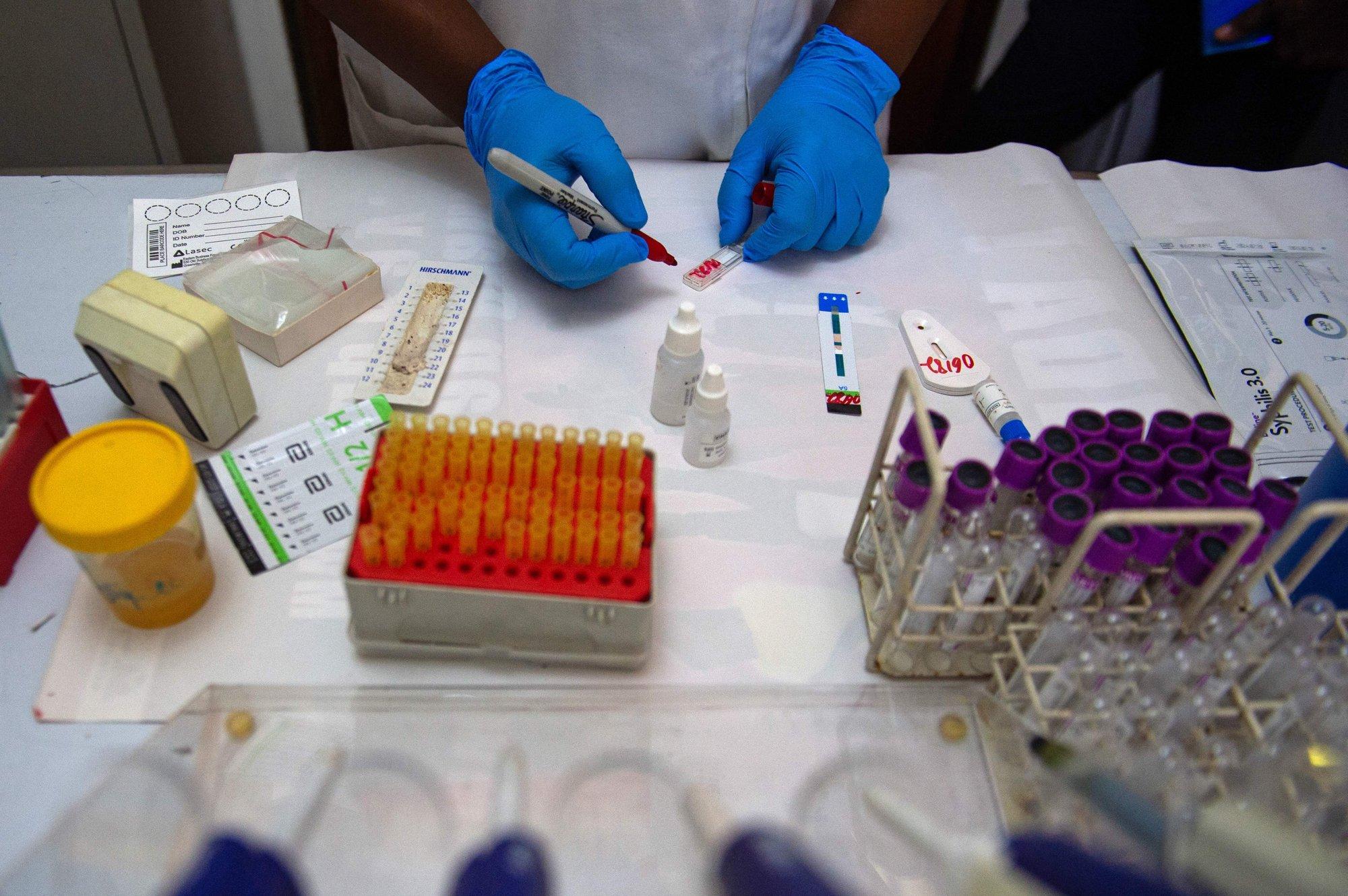 Läbimurre HIV-i ravi otsingutel: teadlased leidsid selle, mida varem peeti võimatuks