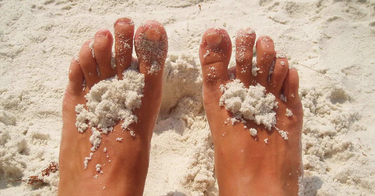 Soovimatu suveniir puhkuselt: kuidas hoida jalad seenhaigusest priid?