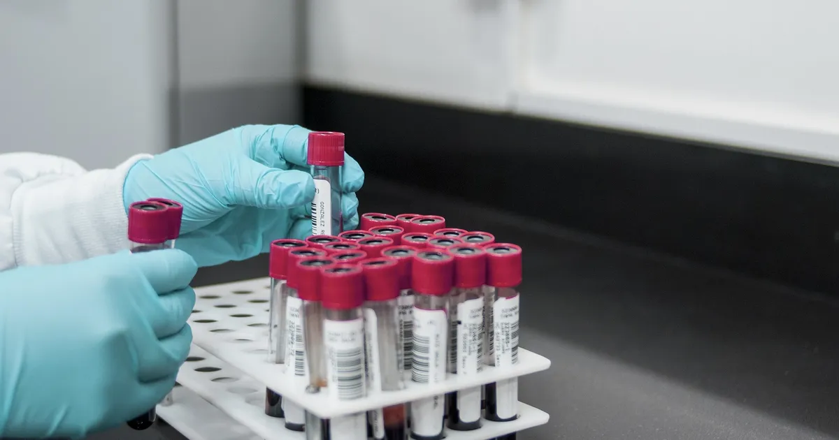 AVASTUS ⟩ Vereproov võib ennustada vähki kolm aastat ette?