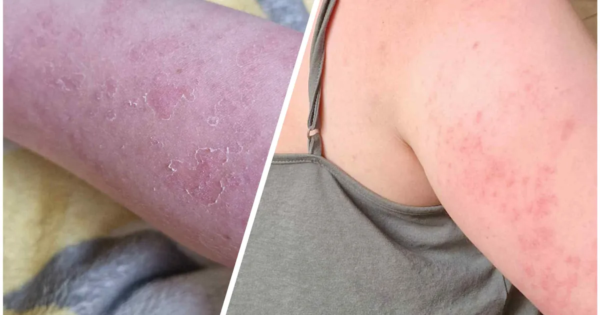 TERVISEAMET HOIATAB ⟩ Päikesekaitse ABC: kuidas olla kindel, et nahk on kaitstud?