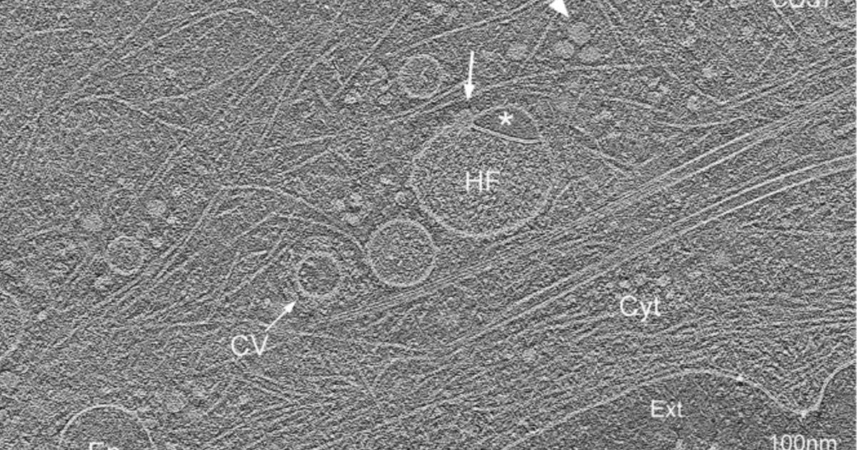 Inimese rakkudest leiti senitundmatu organell – see tilluke mutrike mängib aga väga olulist rolli