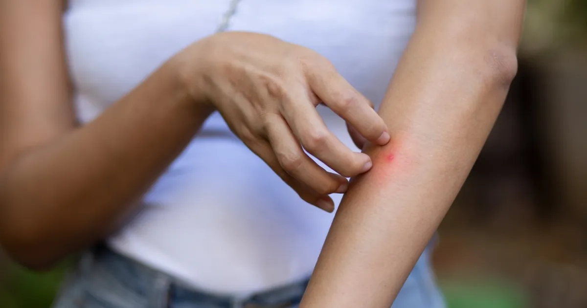 NAISE KOGEMUS ⟩ Sääsehammustuse moodi täpp osutus millekski palju tõsisemaks