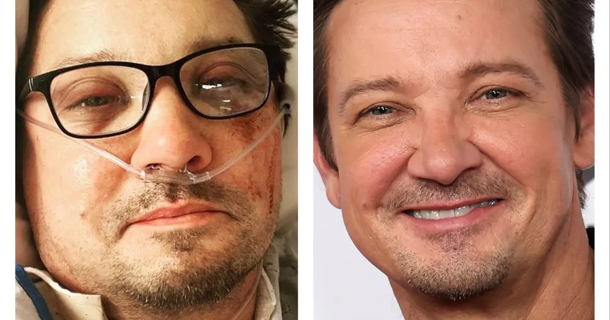 Näitleja Jeremy Renner kirjutas traagilisest õnnetusest raamatu: «Ma surin... ja nüüd tean, et surma ei maksa karta»