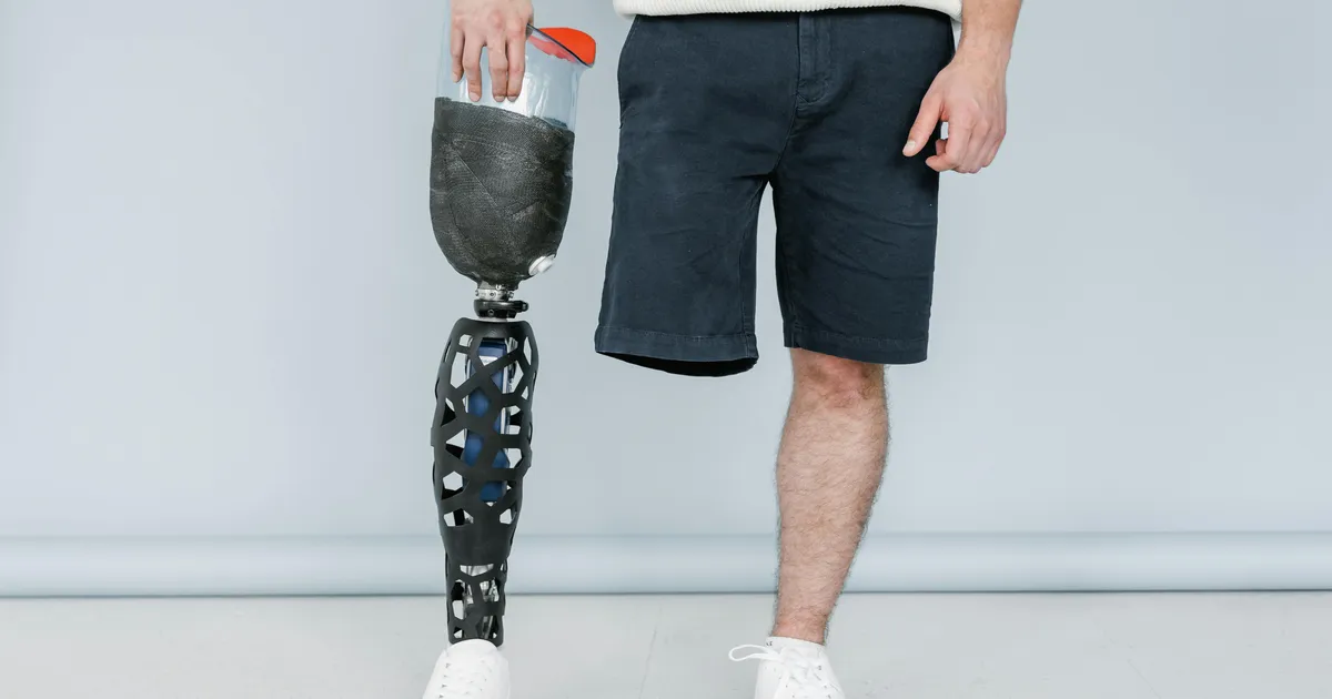 LISATUD VIDEOD ⟩ Ka muidu pealtnäha terve inimene võib ühtäkki jalast ilma jääda – mis seda põhjustab kuidas seda vältida?