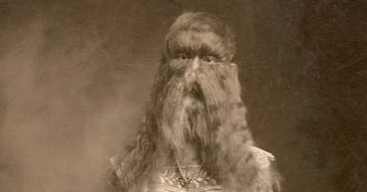 Kuhu kadusid inimeste karvad – teadlased teavad vastust