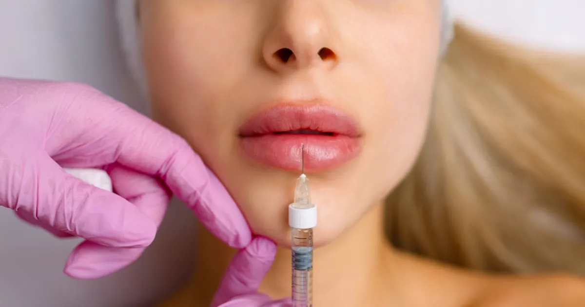 ULME ⟩ Maailma suurimate huultega naine: arst keeldus mind süstimast!