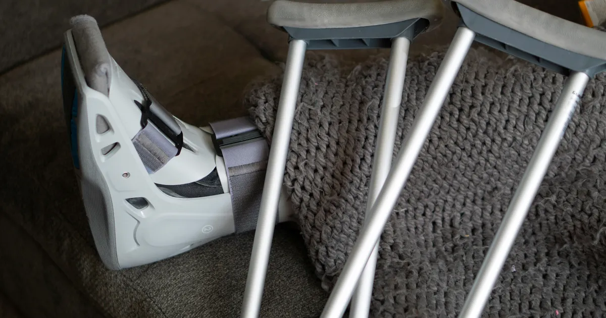 Kogemuslugu: Eesti naine murdis välisreisil jalaluu ja lükkas operatsiooni edasi