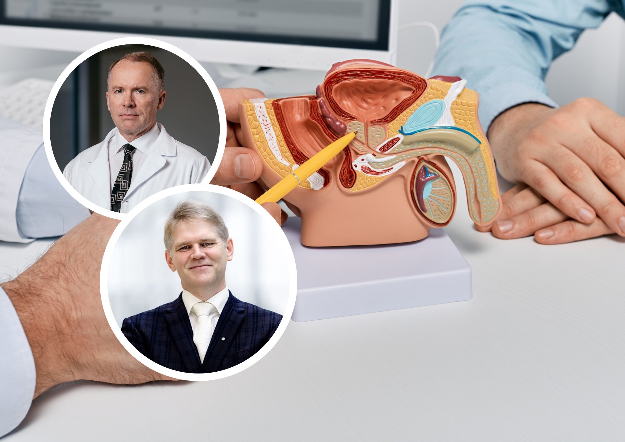 Geenitest aitab avastada ohtlikku eesnäärmevähki juba enne sümptomeid