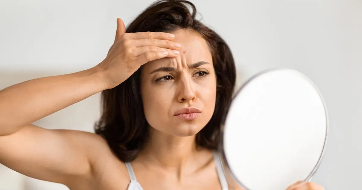 Nahaarstid paljastavad: need toidud võivad su näo tuksi keerata