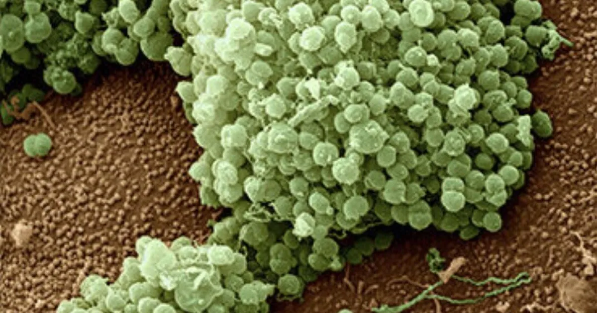 Ühendkuningriik alustab vaktsineerimist selle ravimitele mittealluva suguhaiguse vastu