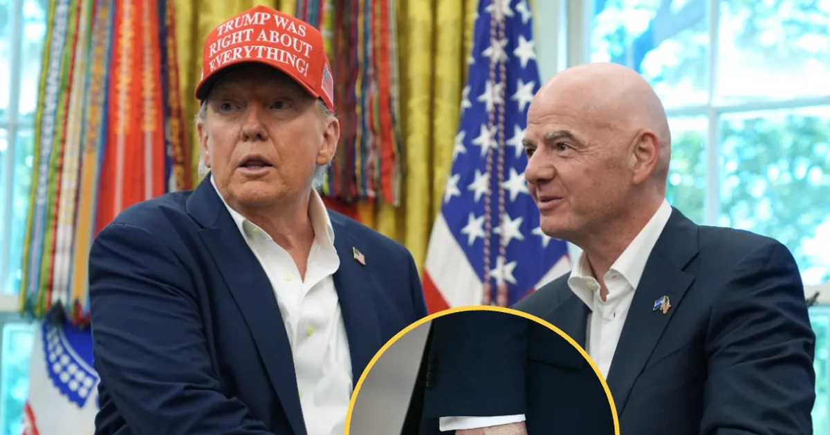 FOTO ⟩ Jumestuskreemiga kaetud Trumpi käsi tekitas küsimusi USA presidendi tervise kohta