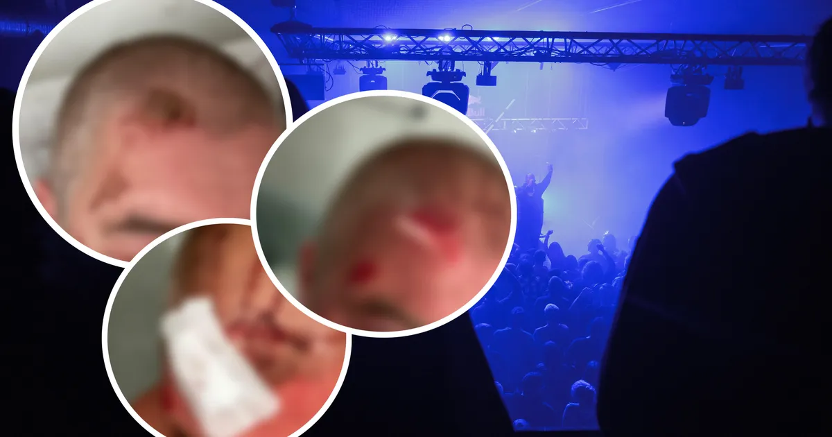 «Käed pandi raudu ja silma lasti pipragaasi!» Tallinlane väidab, et sattus Telliskivis toimunud peol turvameeste vägivalla ohvriks