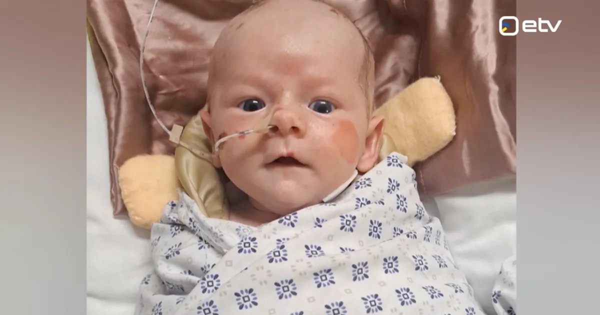 VÄIKE VÕITLEJA ⟩ Üliharuldase geenirikkega pisitütre ema: kindlasti jääb ta paljudest asjadest ilma, loodame, et ravim teeb imesid