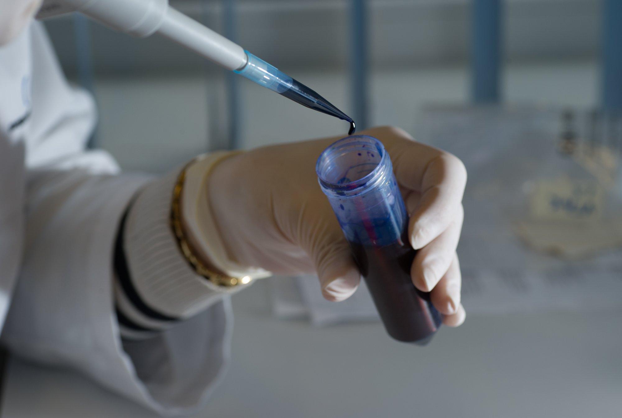 Geenitestidega tegeleva Asper Biogene isikuandmete lekke kohtuvaidlus on läbi ja trahv tühistatud